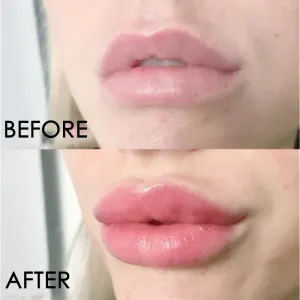 Instant Lip Enhancer Plumper Oil: Extreme Volumizing Lip Gloss Serum for Nourishment, Anti-Wrinkle Moisturization, and Sexy Lip Care Cosmetics