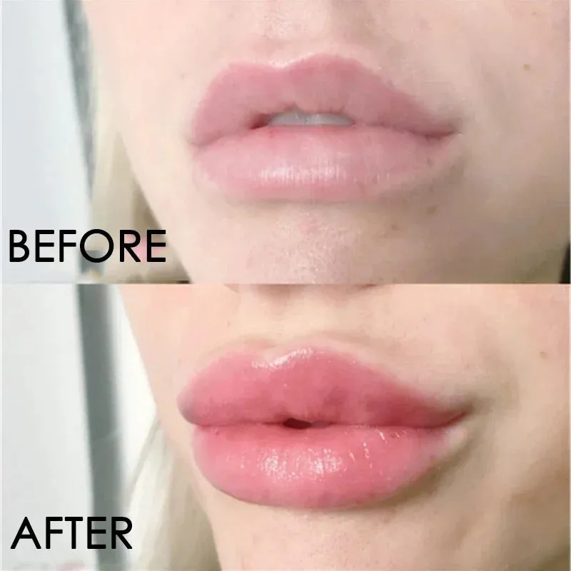 Instant Lip Enhancer Plumper Oil: Extreme Volumizing Lip Gloss Serum for Nourishment, Anti-Wrinkle Moisturization, and Sexy Lip Care Cosmetics