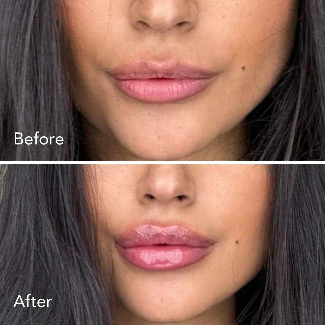 Smooche - Extreme Lip Plumper - Transparent